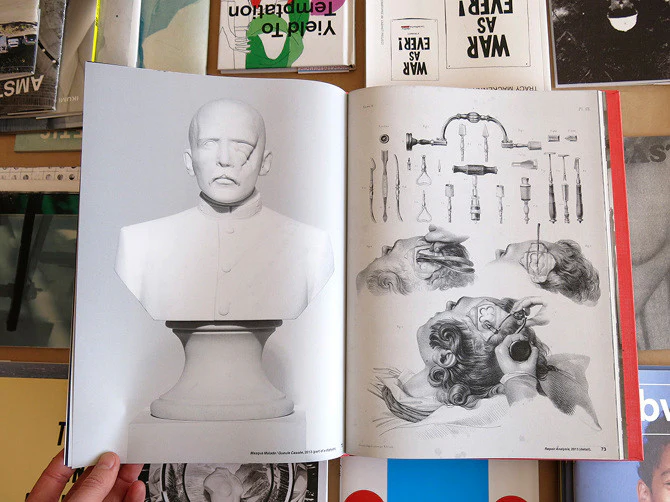Kader Attia - Transformations - Image 8