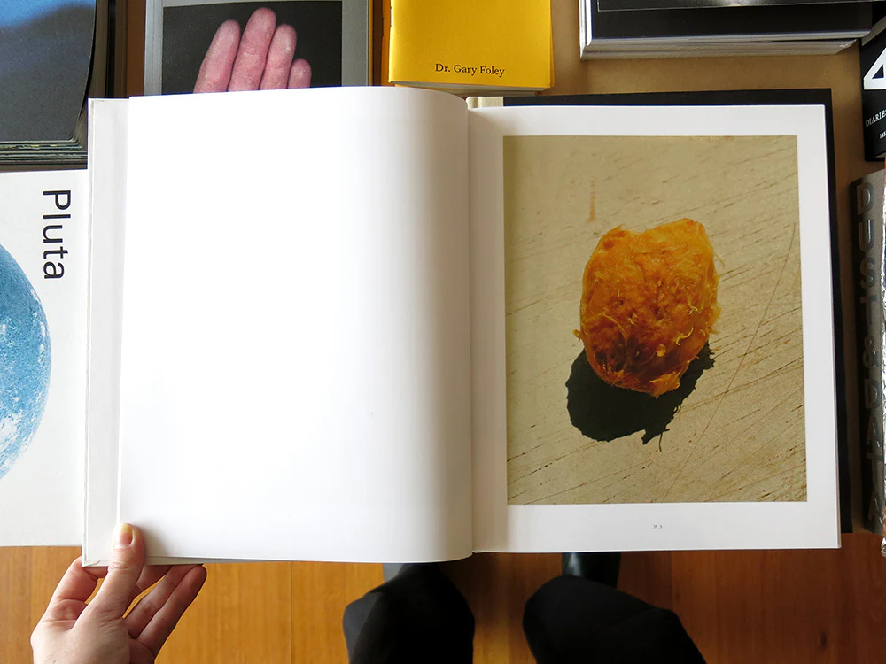 Molly Matalon – When a Man Loves a Woman - Image 2